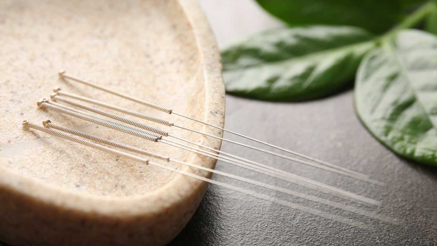 Acupuncture and Anxiety Harbour Health